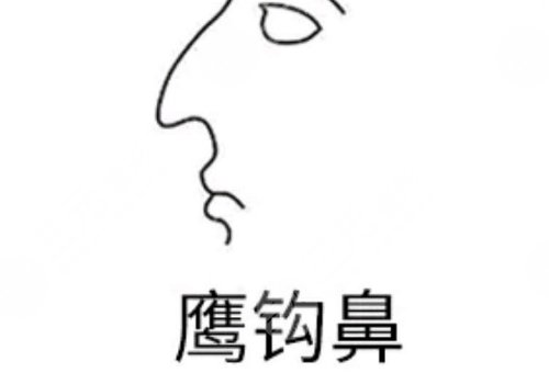 海鸥线和鹰钩鼻的区别