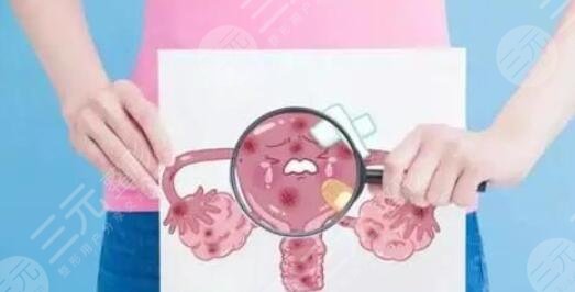 私密紧缩