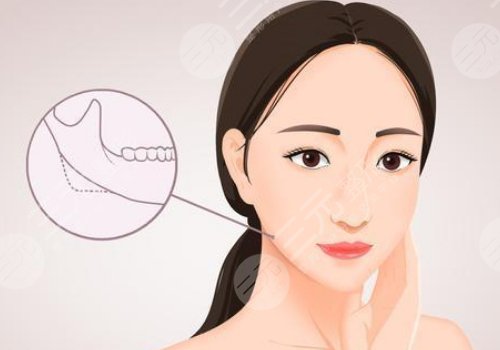 轮廓固定怎么做？