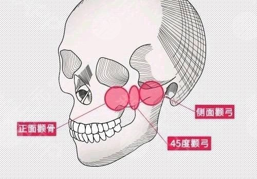 方脸削骨大概多少钱?