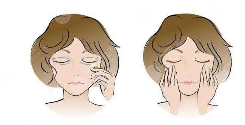 外切眼袋一般要多久才能完全恢复