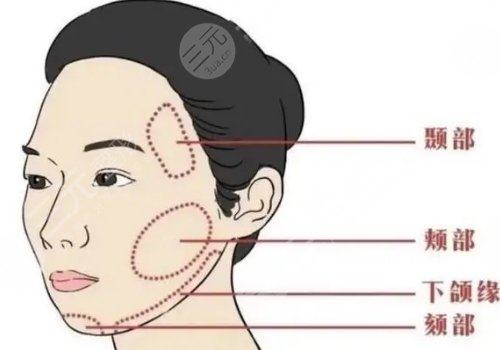 外轮廓填充用什么好？