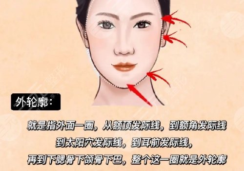 外轮廓填充用什么好？