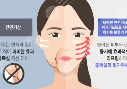 面部轮廓固定能维持多久？