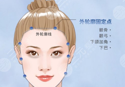 面部轮廓固定能维持多久？