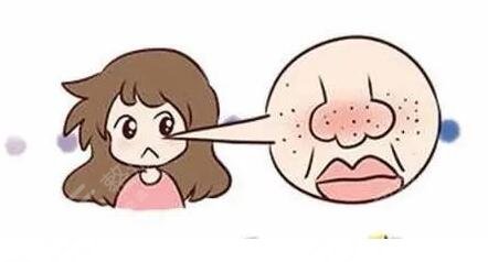 注意防晒