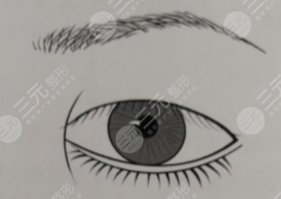 开眼角留疤了怎么办缓解？本文提供3种方法针对开眼角留疤问题！