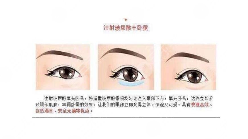注射卧蚕有什么风险
