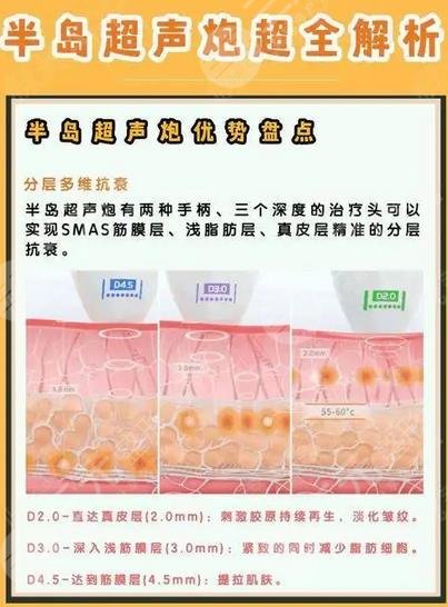 超声炮的作用如何?