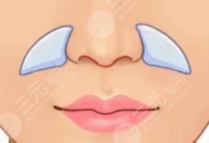 鼻基底