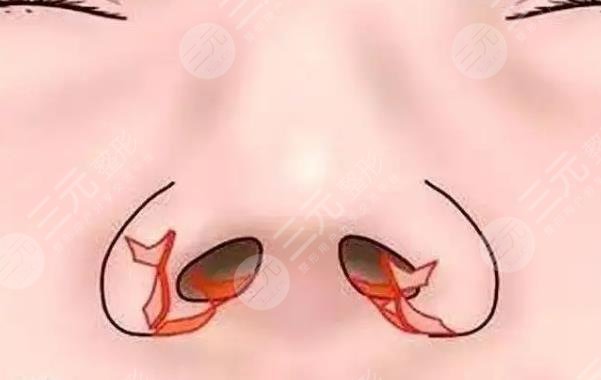 鼻基底
