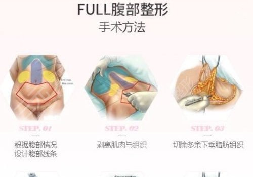 腹部拉皮手术费多少钱？