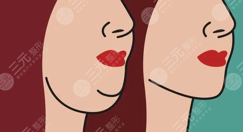 甩掉双下巴的方法