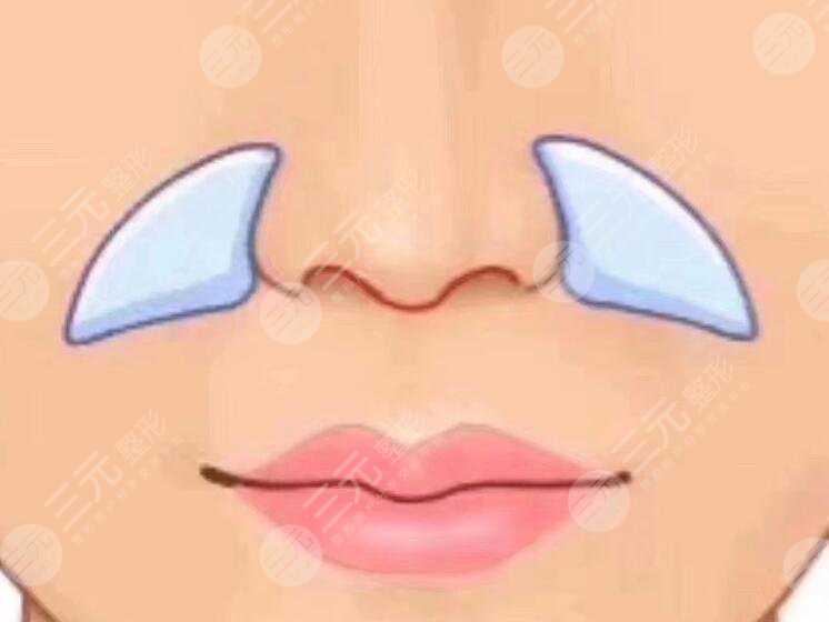 填充鼻基底