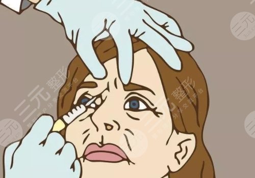 幼态脸需要做哪些整形？