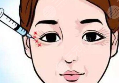 注射除皱眼部效果好吗？