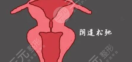 私密缩紧