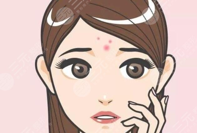 额头长痘