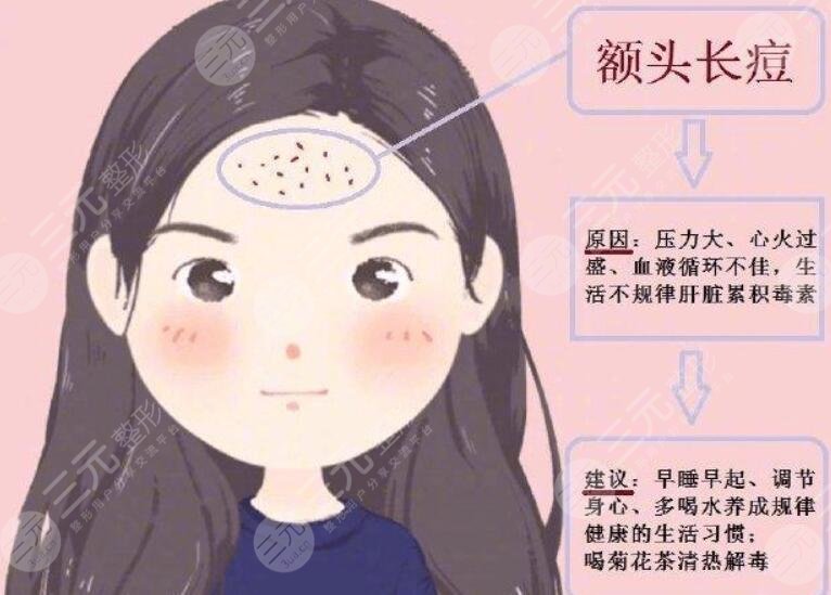 额头长痘