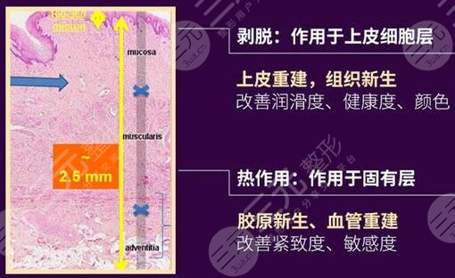 私密整形