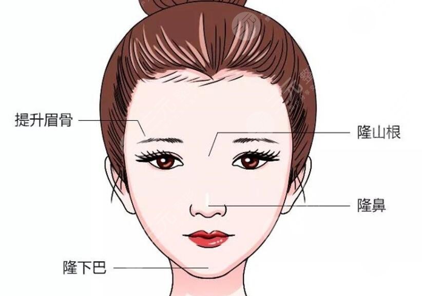 骨性玻尿酸