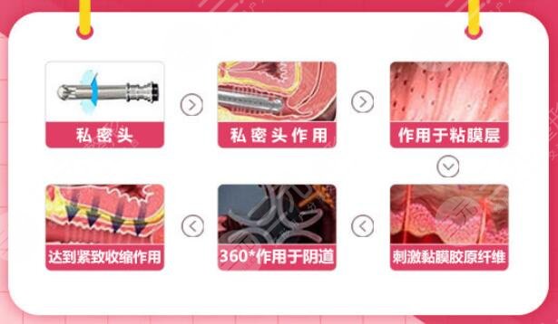 私密缩紧