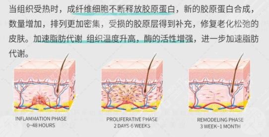 7d聚拉提和半岛超声炮的区别