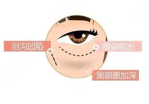 眼周抗衰综合多少钱做一次？