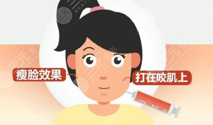 瘦脸针