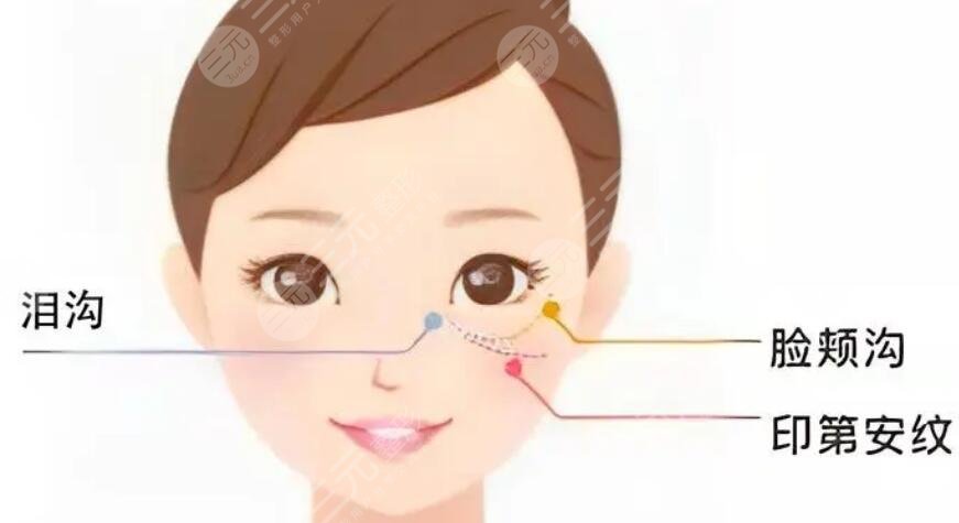 面部提升