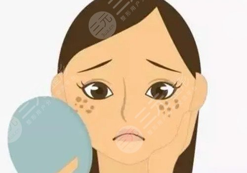 激光祛斑能维持几年？