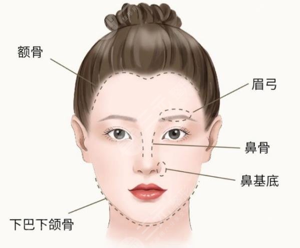 骨相塑形