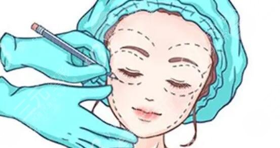 面部轮廓整形