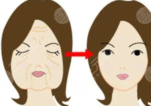 面部紧致的方法有哪些？