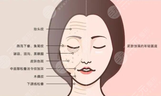分层抗衰