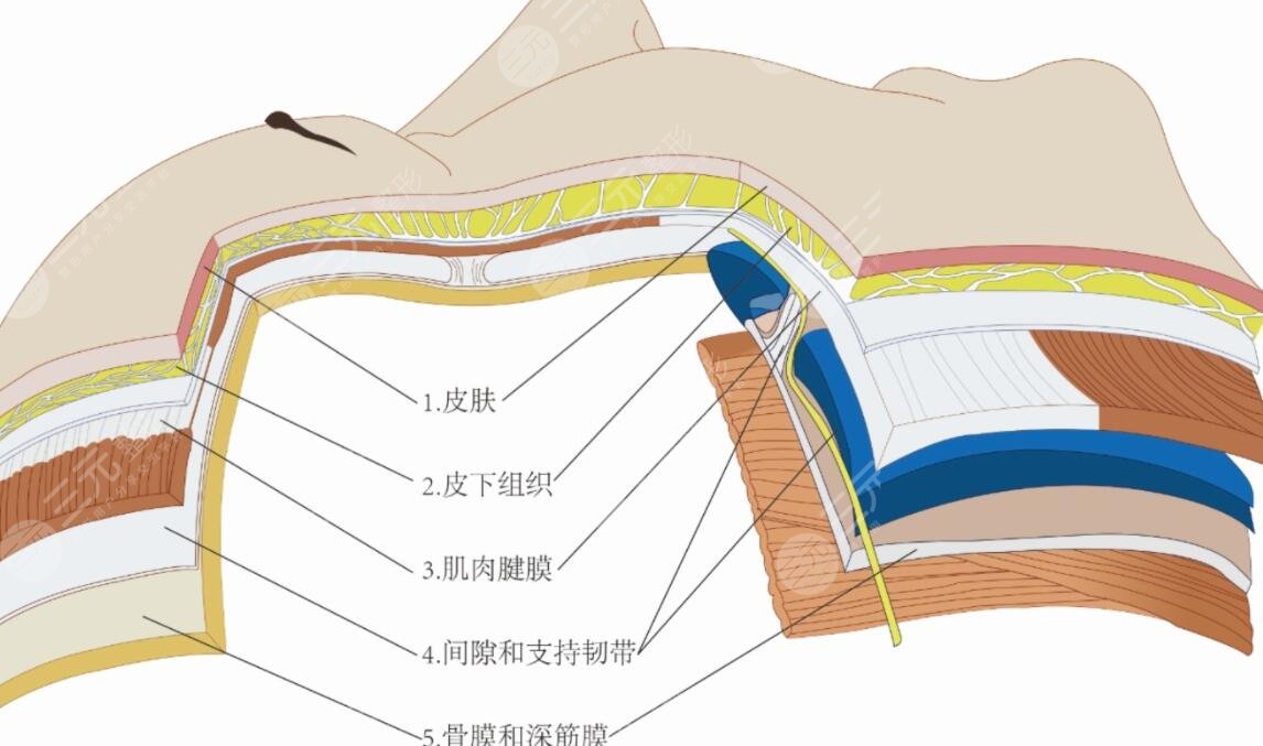 分层抗衰