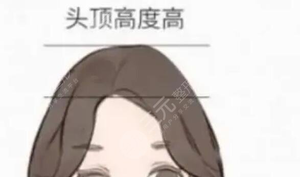 抬高颅顶