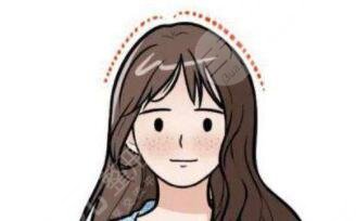 抬高颅顶