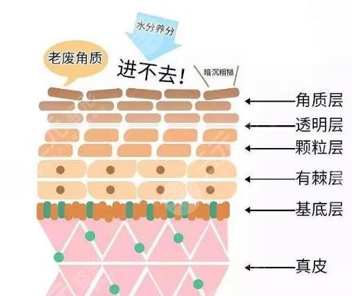 角质