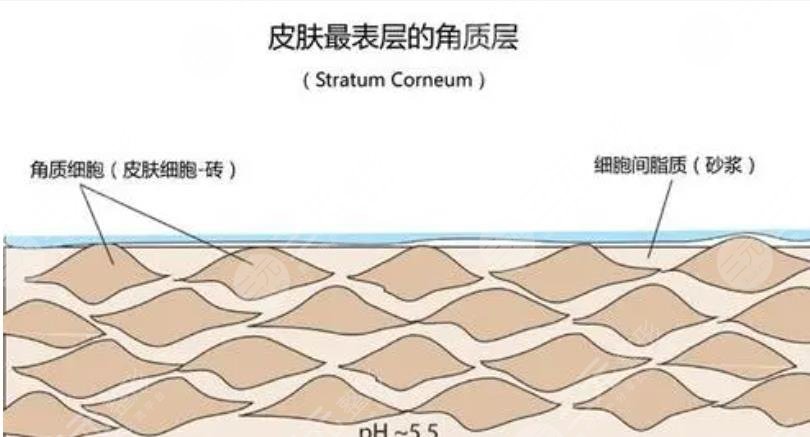 角质