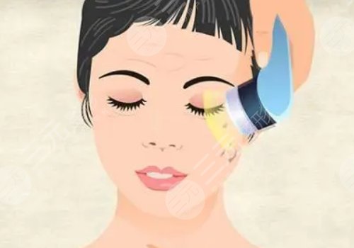fotona4D和热玛吉的区别