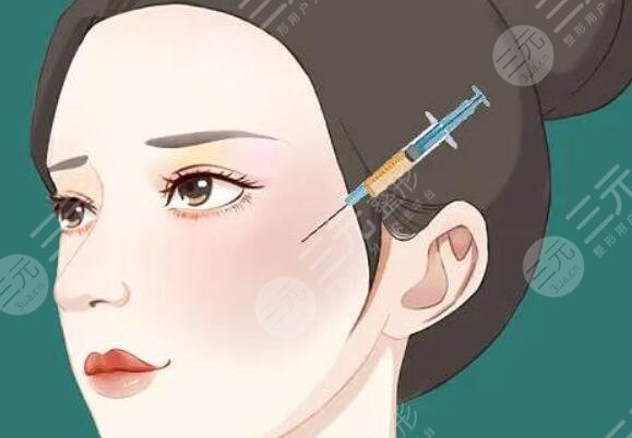 眼凹陷脂肪填充