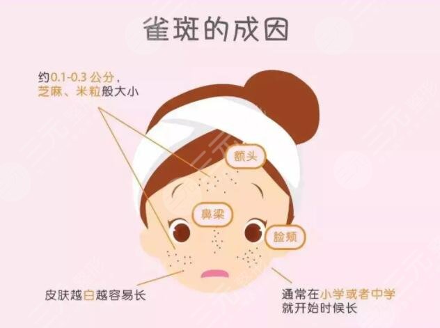 使用光学祛斑仪如何护理才不会影响具体效果?
