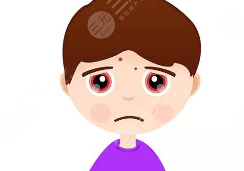 用什么去痘印效果好又不留痘？