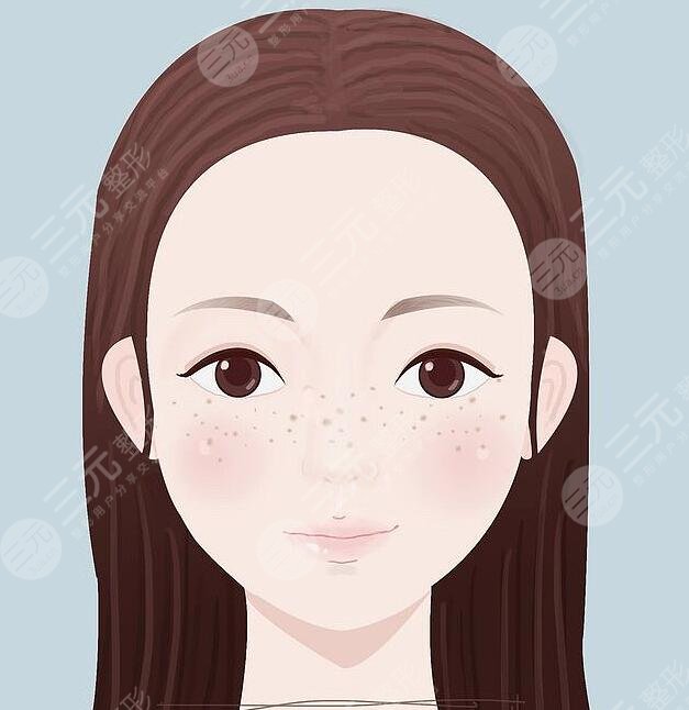 用什么方法可以去斑？内调+外治结合，彻底击碎斑斑点点！