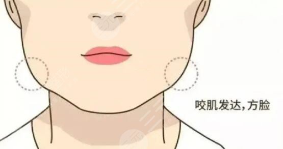 脸上肉多怎样瘦脸有效？做瘦脸操可以成功瘦脸吗？