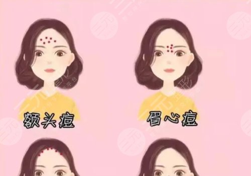 额头长了很多密密麻麻的小痘痘是什么原因