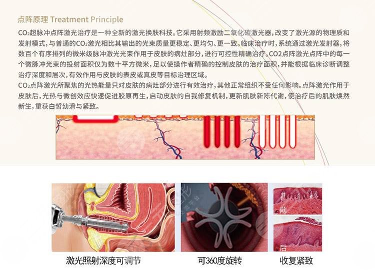 私密缩紧