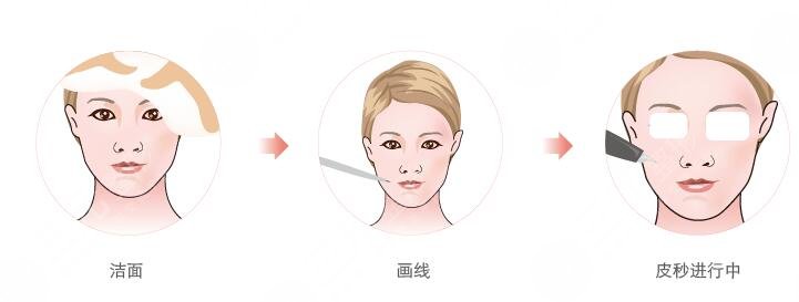 美白注射，水光注射管用吗?