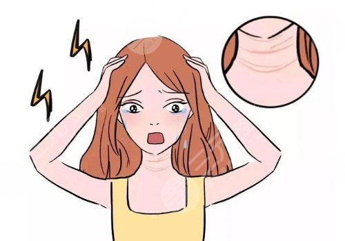 颈纹是什么原因造成的？